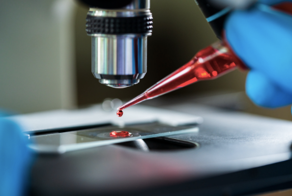 Blood sample on lab slide