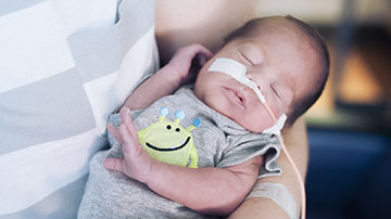 newborn with feeding tube