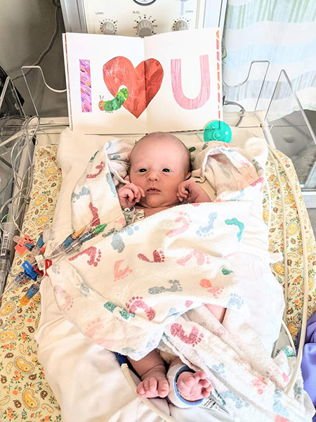 Abigail as a newborn Newborn baby connected to life-saving medical equipment