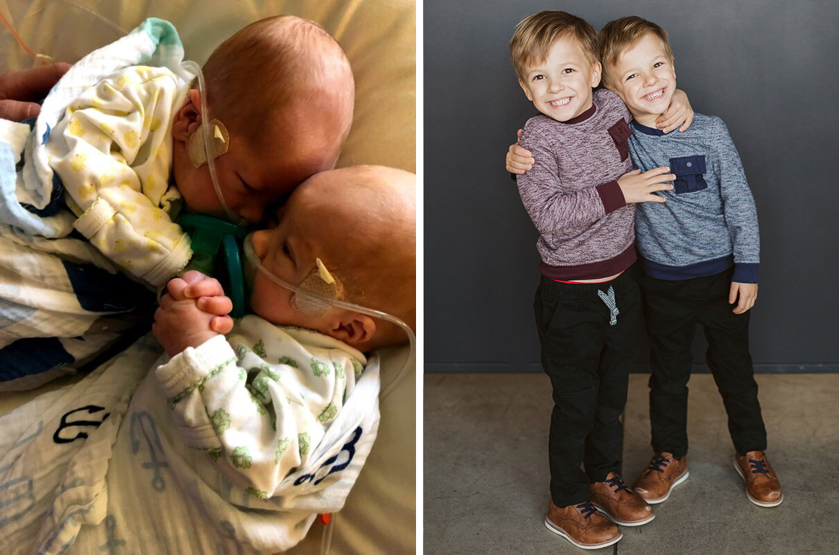 Jack and Liam Jack and Liam at 45 days old and at 5.